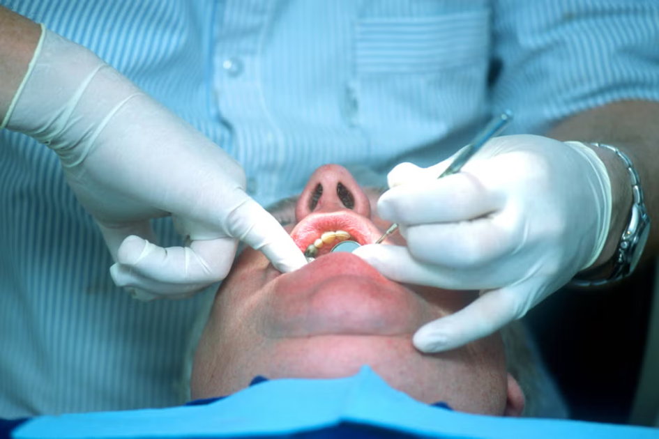 European Decision to Ban Amalgam Dental Fillings Will Impact the NHS Dental Sector